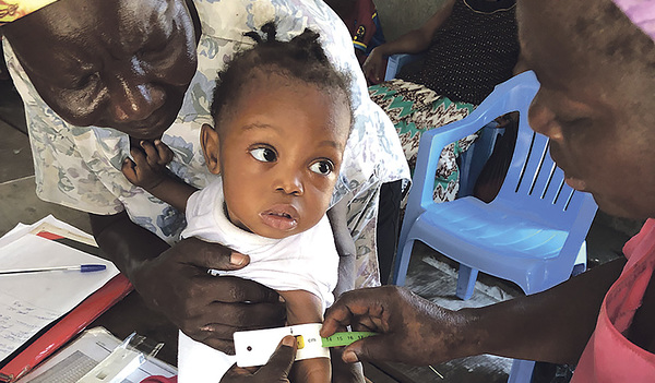 Die Caritas versorgt unterernährte Kinder im Kongo. Bevor das Kind den nahrhaften Brei bekommt, wird durch eine Untersuchung der Grad der Unterernährung festgestellt.