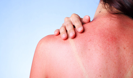 Sonnenlicht hebt unsere Stimmung und tut unserer Gesundheit gut, zu viel davon kann Kopf und Körper aber schaden.           