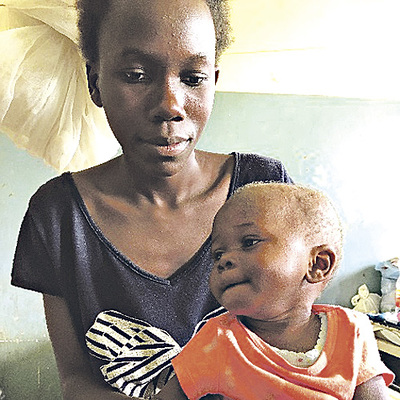 Noella mit ihrer Tochter Julie. Beide leiden an Tuberkulose. Mit 13 Monaten wog das Mädchen dreieinhalb Kilo. Auf der Ernährungsstation hat sie ein Kilo zugenommen.