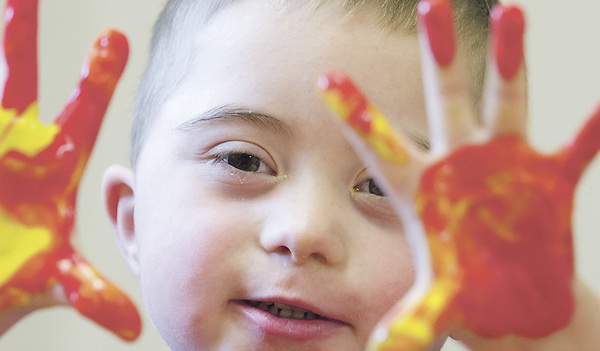 Die deutsche Caritas warnt vor einer Gesellschaft, in der ein behindertes Kind als Schaden empfunden wird.